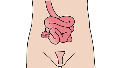 회장루란 무엇인가?